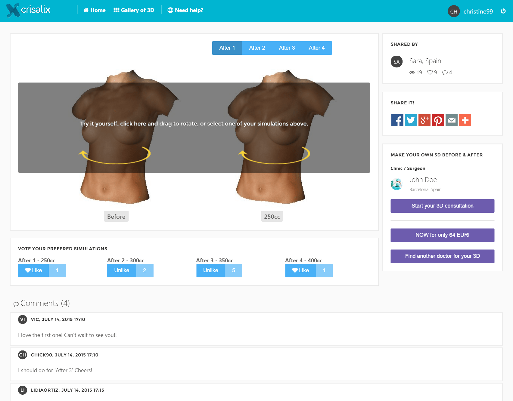 Crisalix gallery image