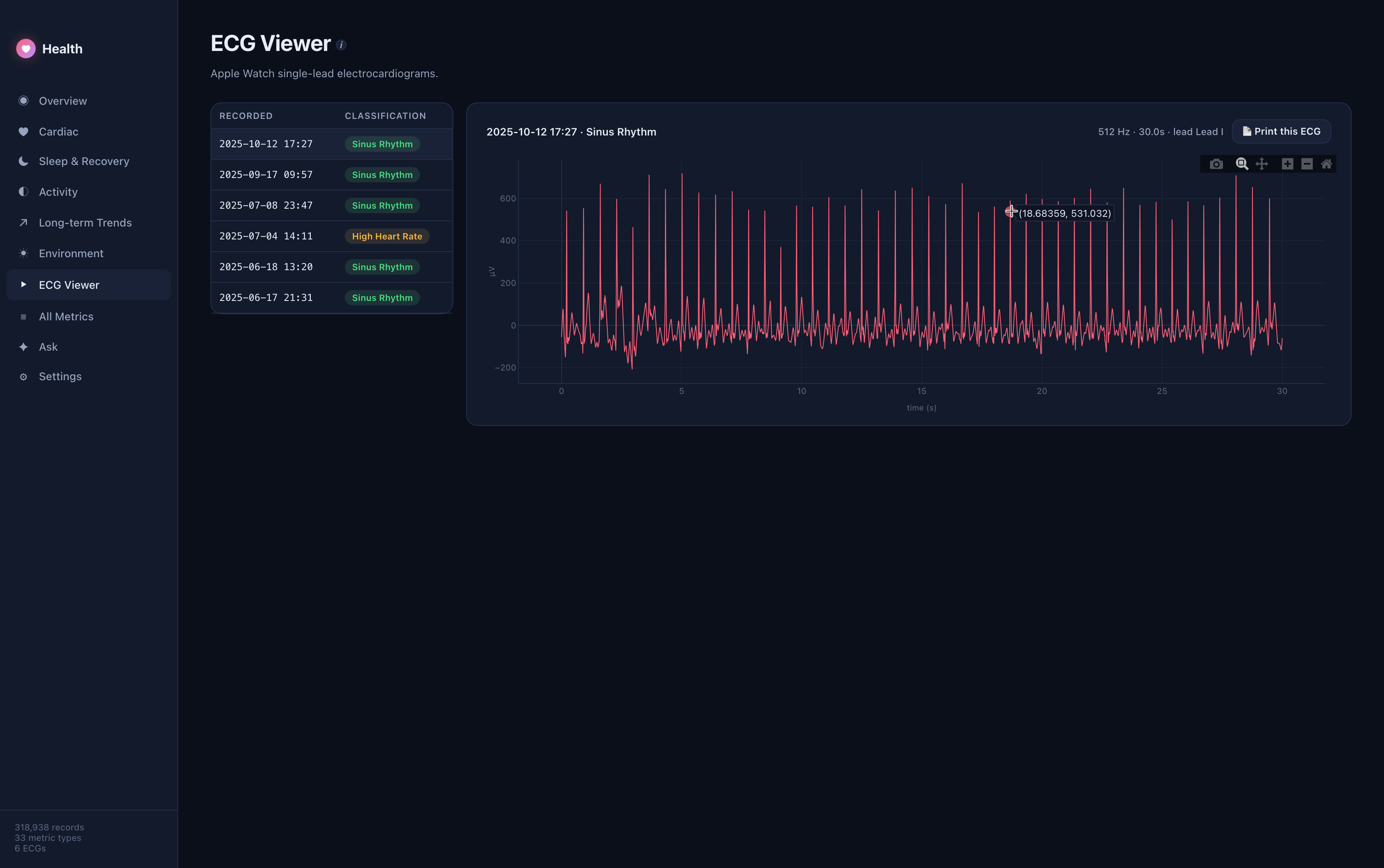 Health Dashboard, see Watch data on Mac. gallery image