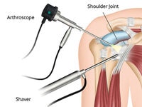 orthopedic hospital in jaipur