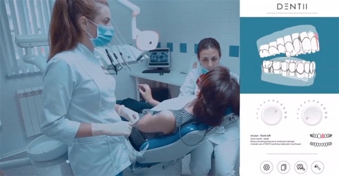 Dentii gallery image