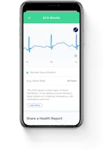 ScanWatch gallery image