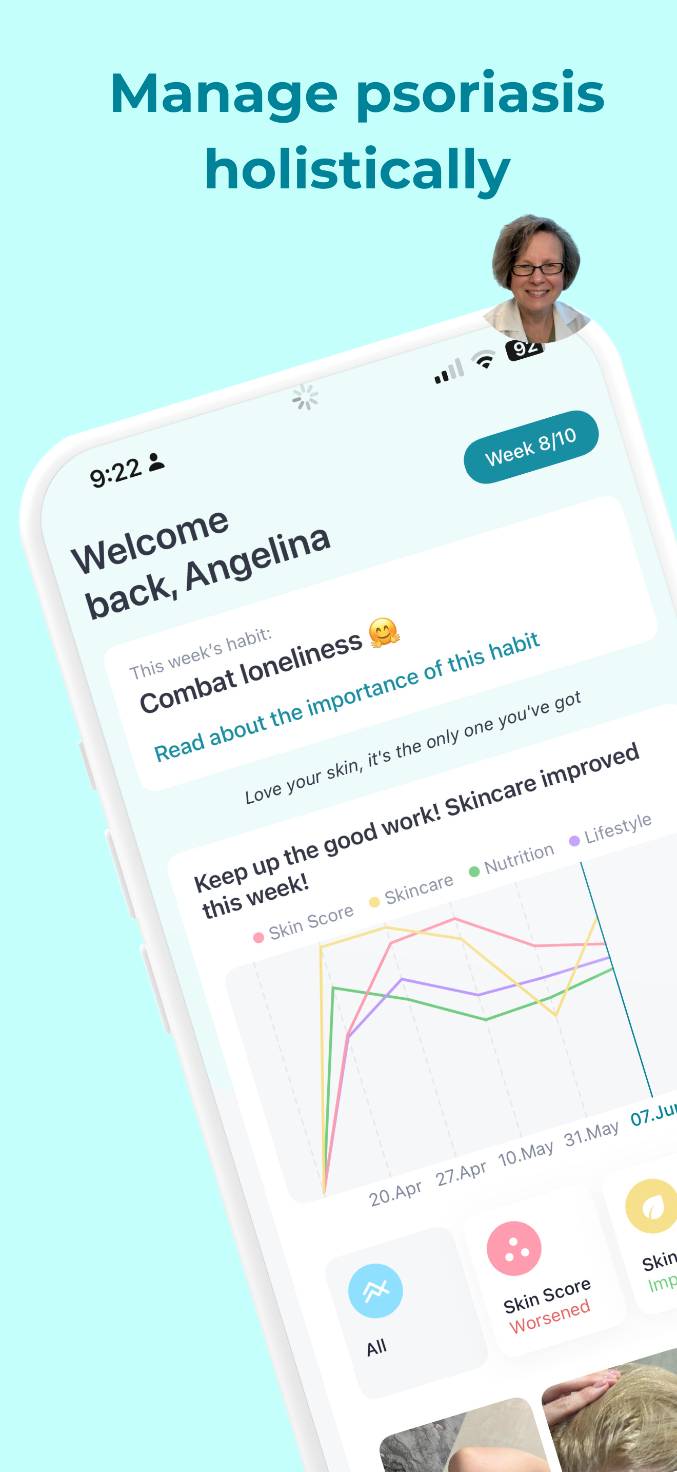 startuptile Aqt Psoriasis Coach-The first app for comprehensive psoriasis care