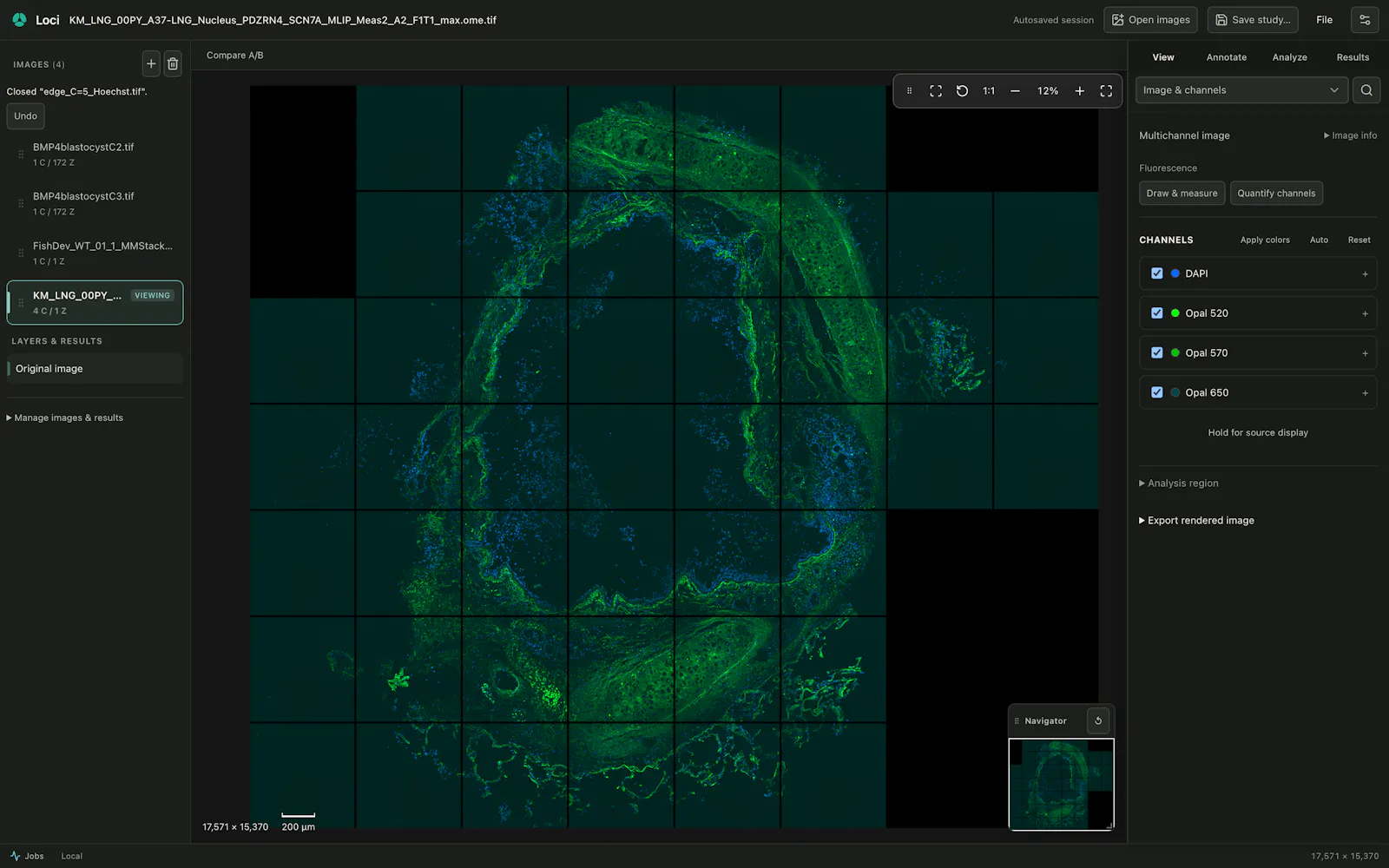 Loci screenshot 3