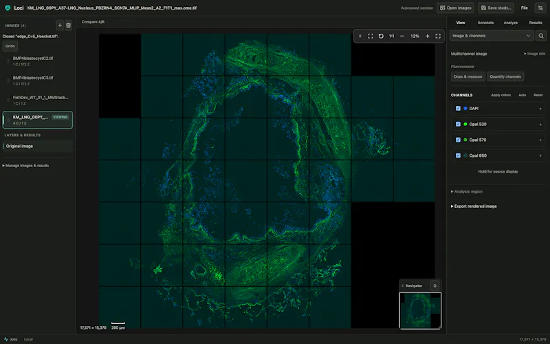 Loci screenshot 3