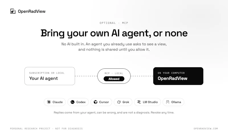 OpenRadView screenshot 5