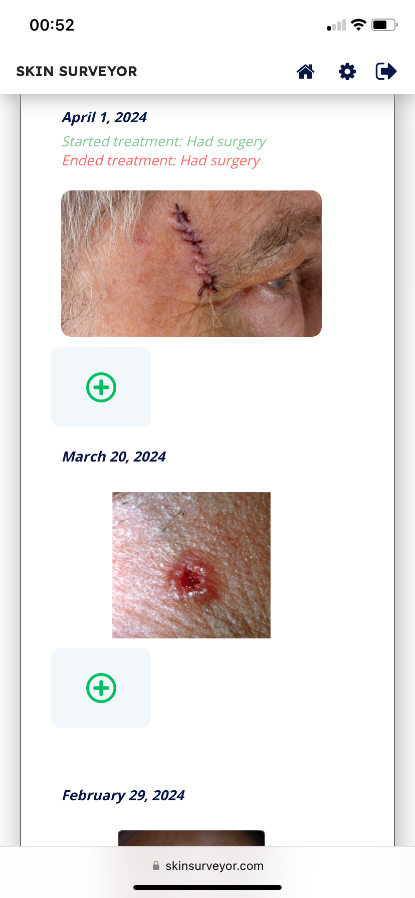 Skin Surveyor - Оптимизируйте здоровье кожи с любого устройства. медиа 5