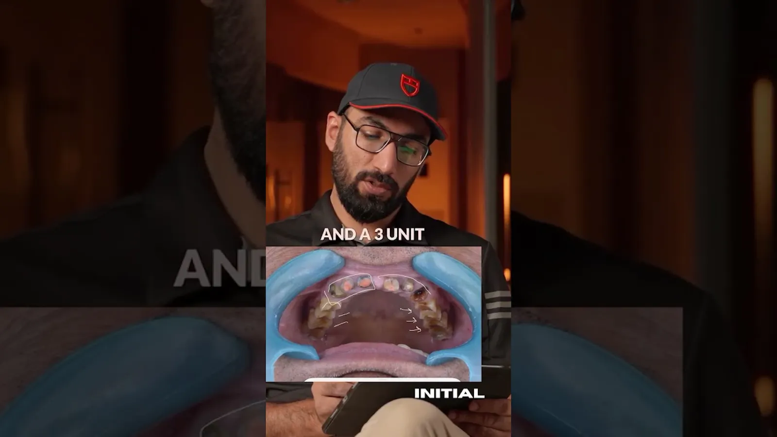Teeth & Gums screenshot 1 (video preview)