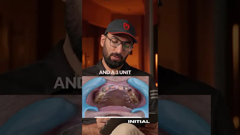 Teeth & Gums screenshot 1 (video preview)