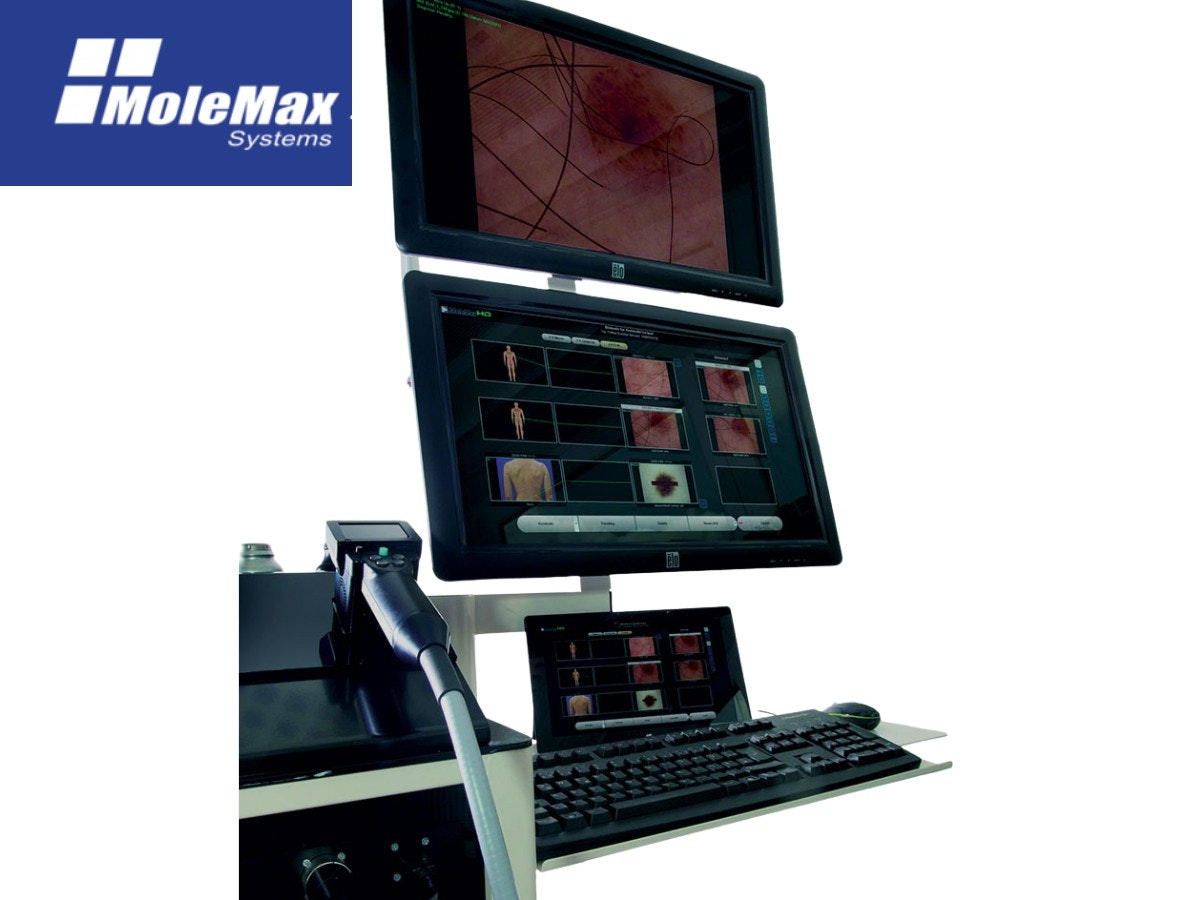 MoleMax System gallery image