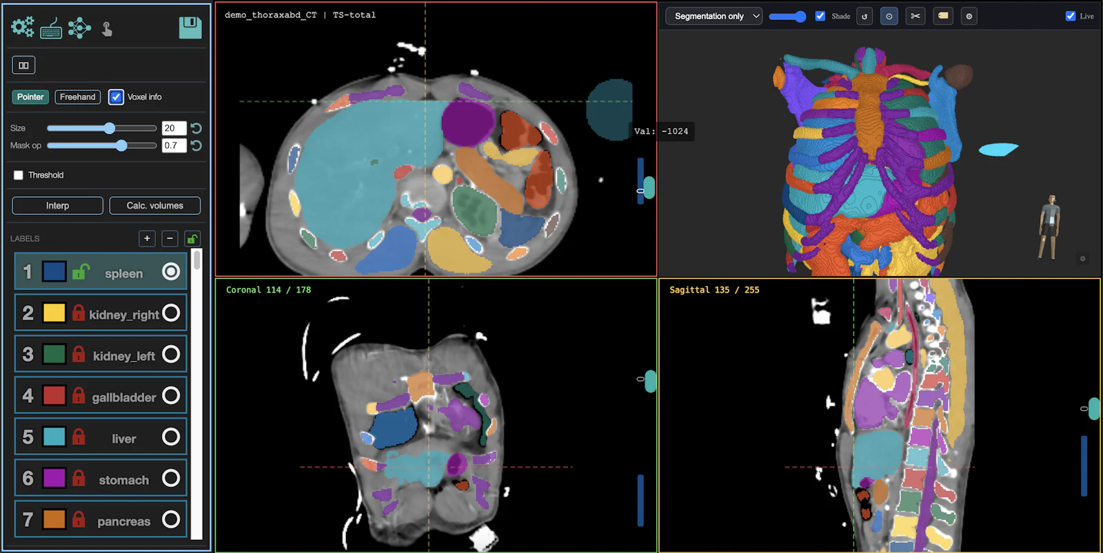 MedSeg screenshot 4