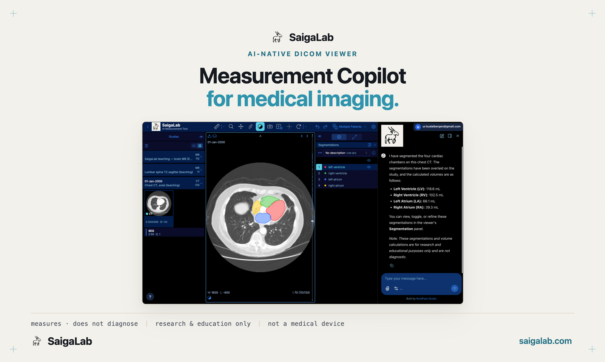 SaigaLab gallery image