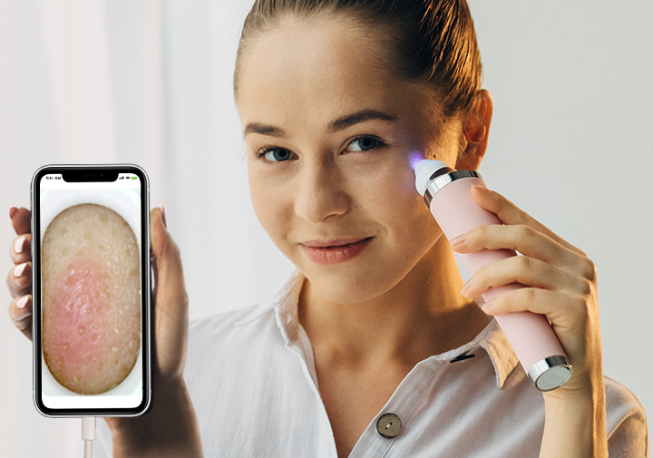 Porfee: Blackhead vacuum 