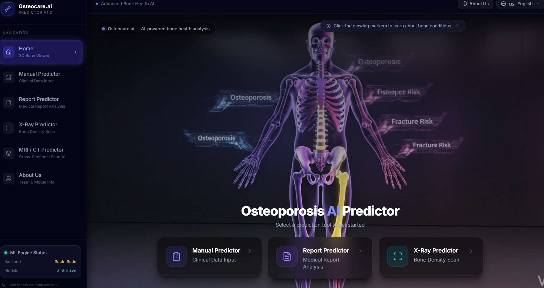Osteoporosis Disease Predictor