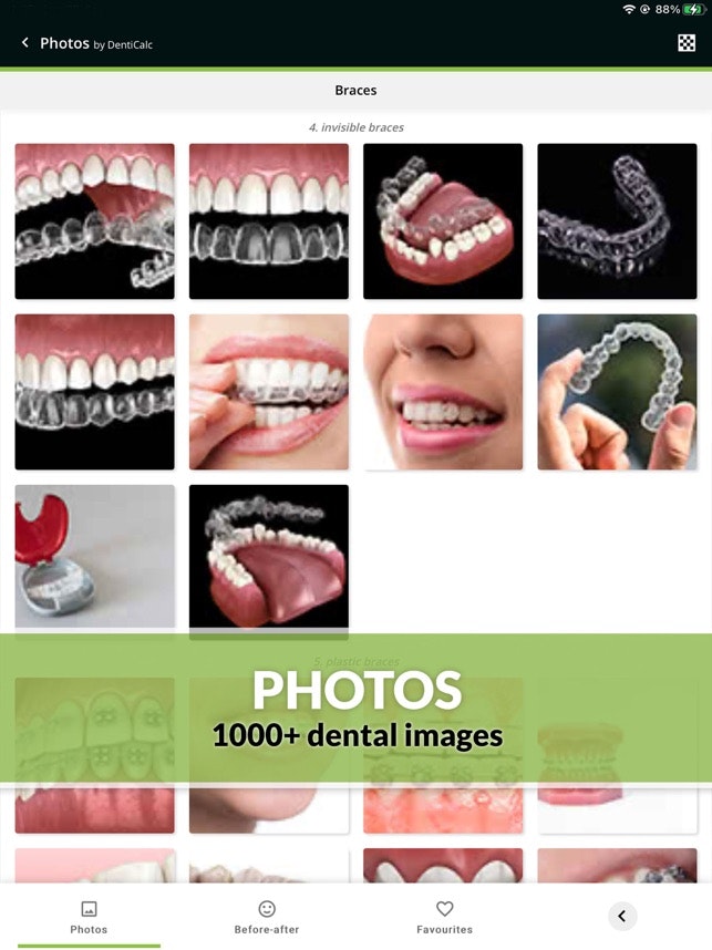 DentiCalc gallery image