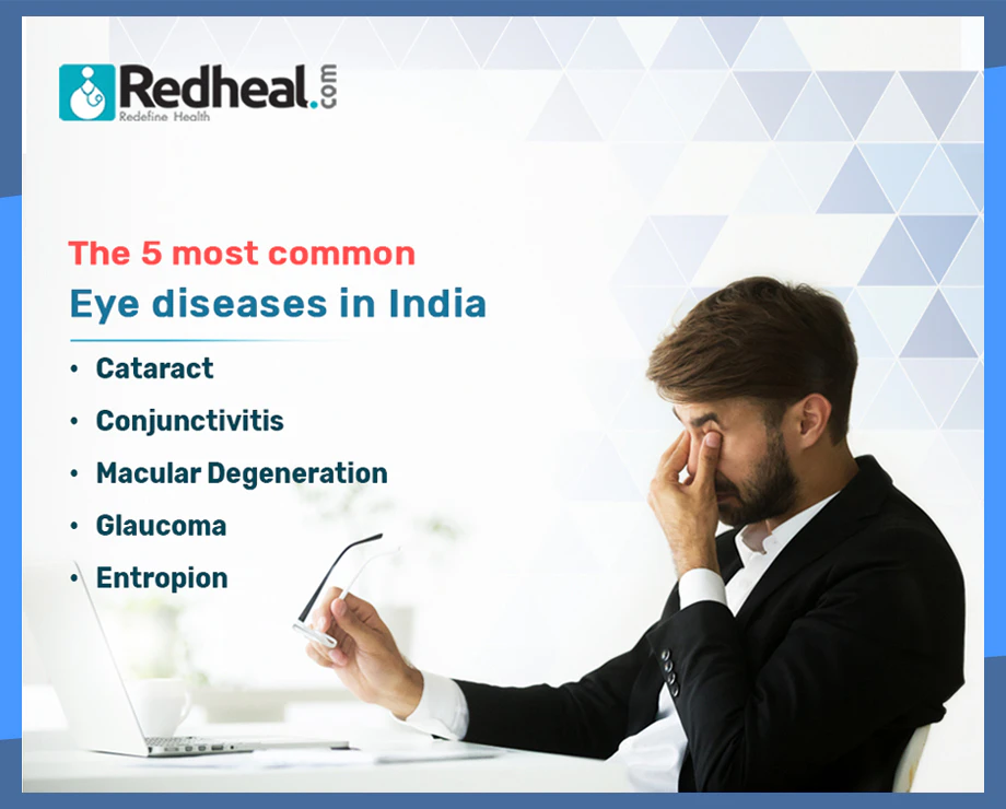 Free Eye Consultation, free eye checkup