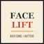 Facelift