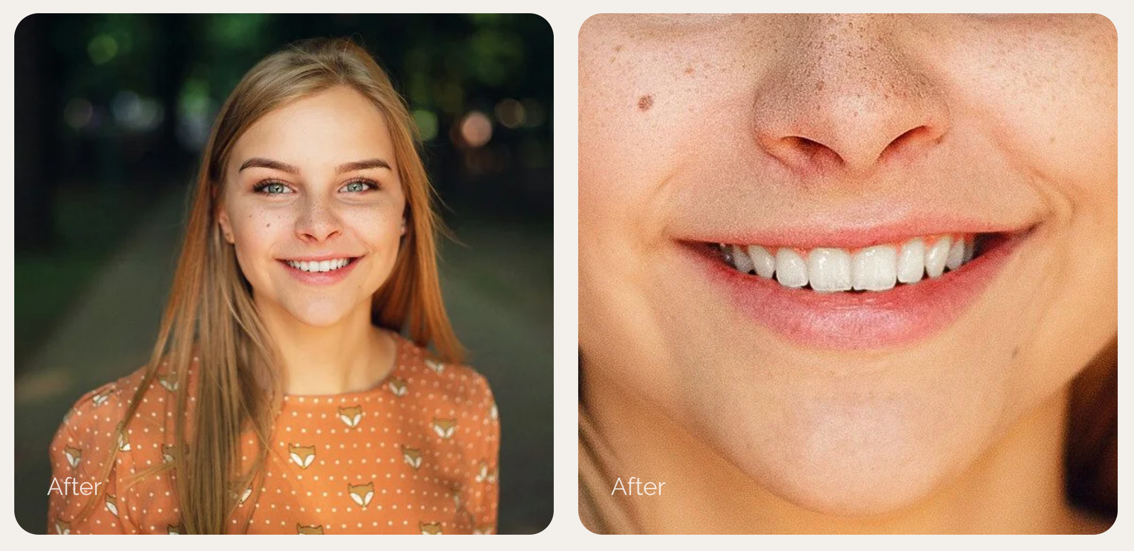 Retouch4me White Teeth - Screenshot 2 preview