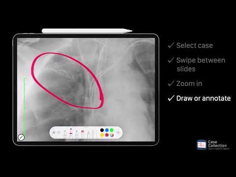 Case Collection gallery image