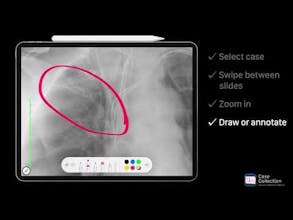 Case Collection gallery image