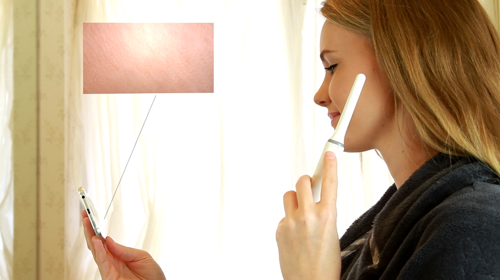 ScopeAround gallery image