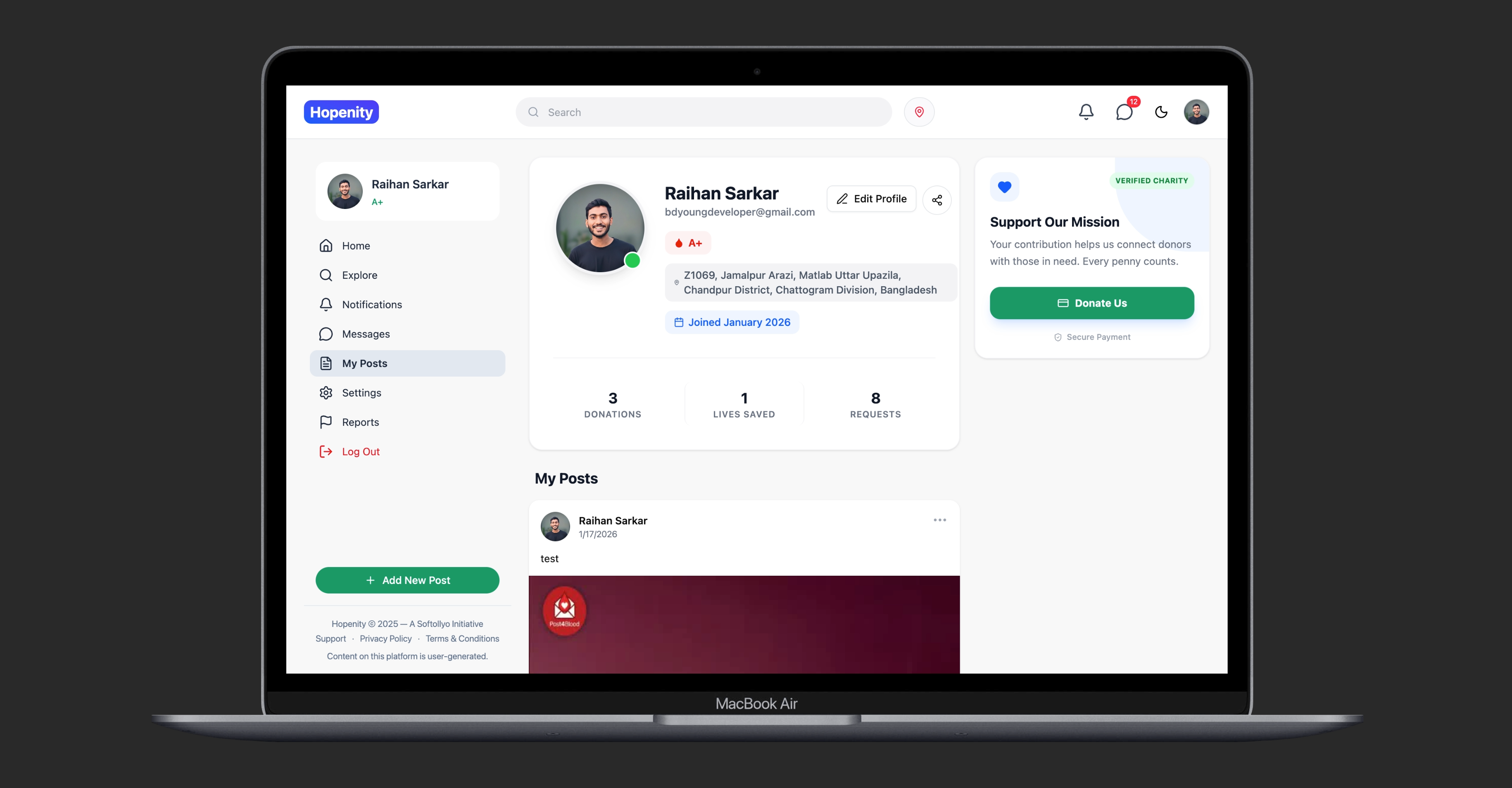 Hopenity gallery image