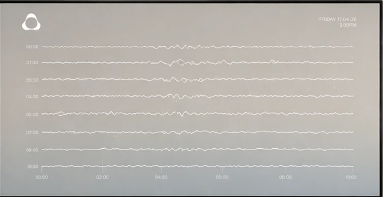 Nura Scan by Evolve Neuro screenshot 3