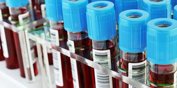 Biotech Research Group cover