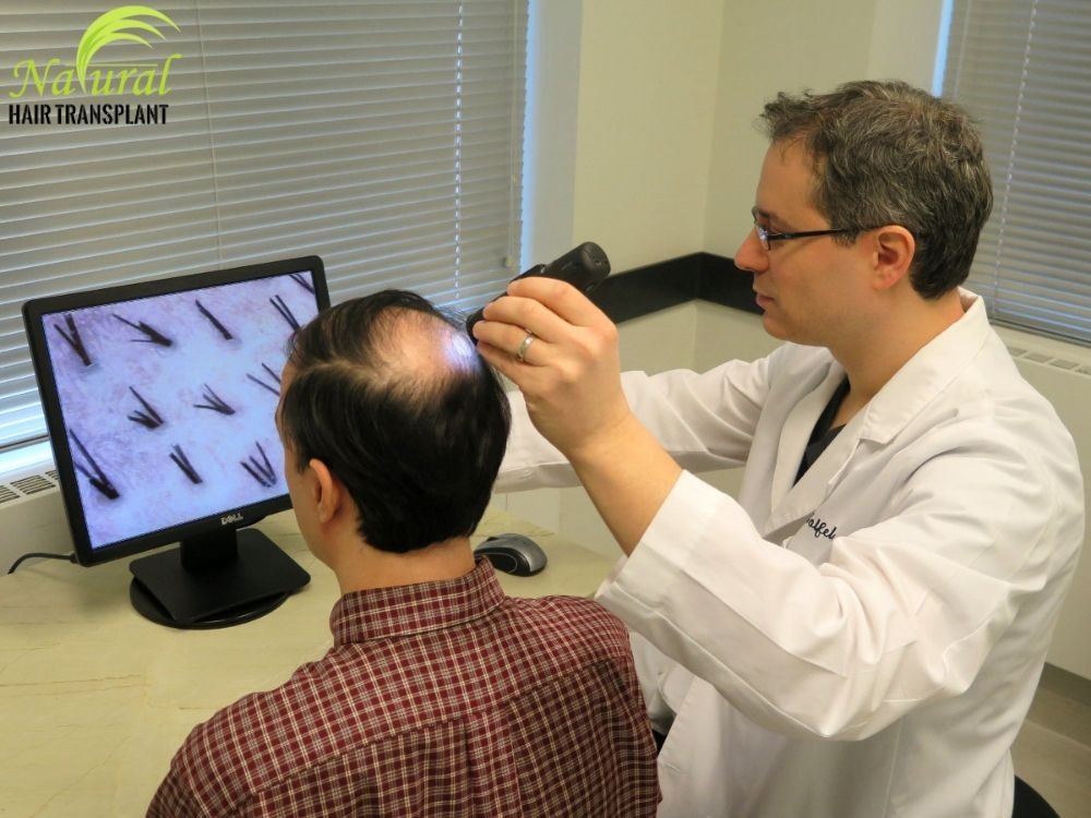 hair transplant gallery image