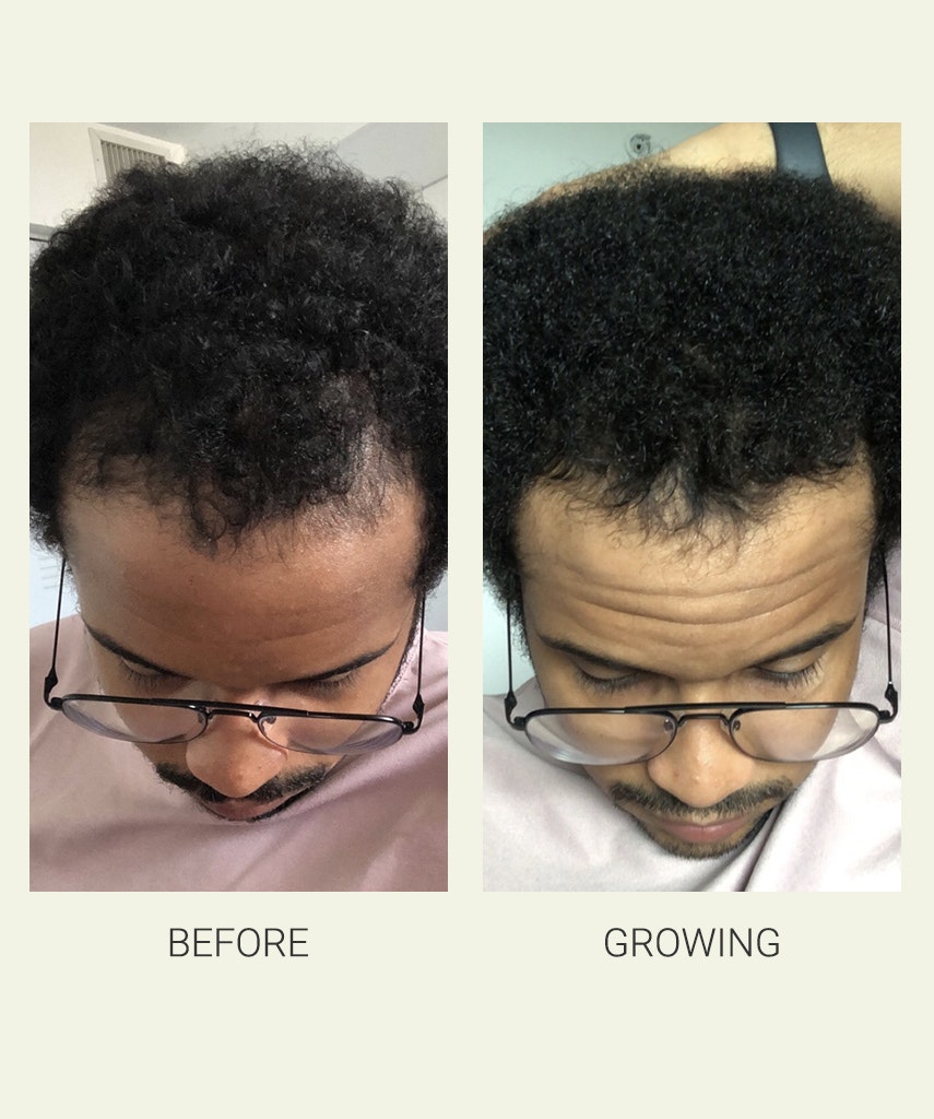 Activating Serum gallery image