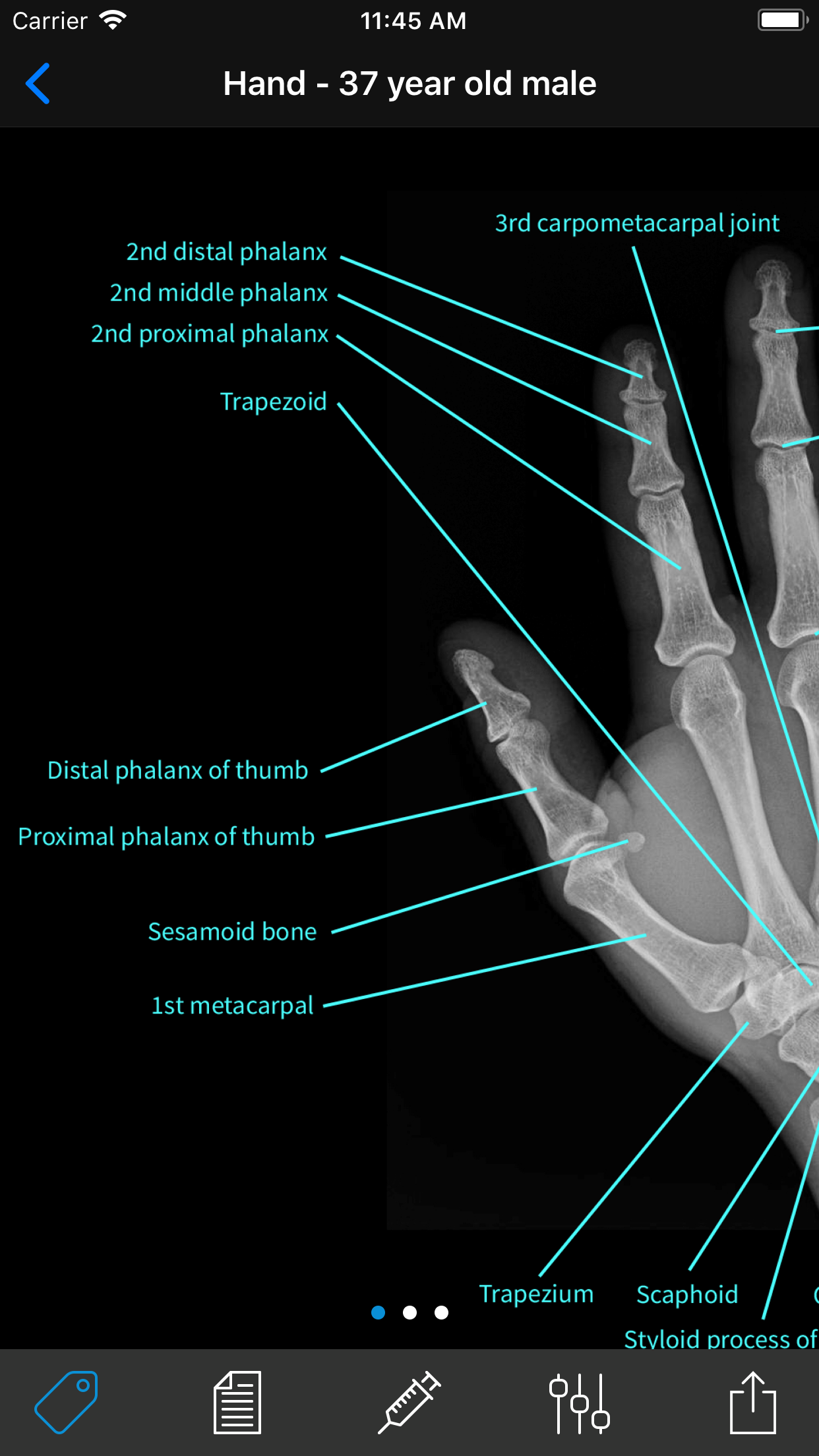 X-Rays: Atlas of Human Anatomy gallery image