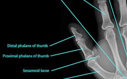 X-Rays: Atlas of Human Anatomy media 2