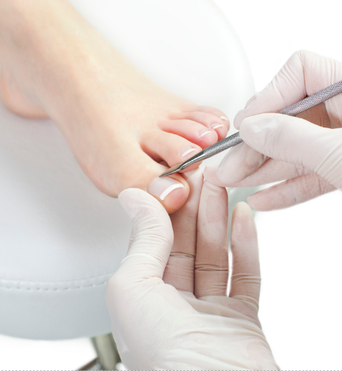 Mejor pedicura médica Londres