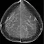 NeuralRad