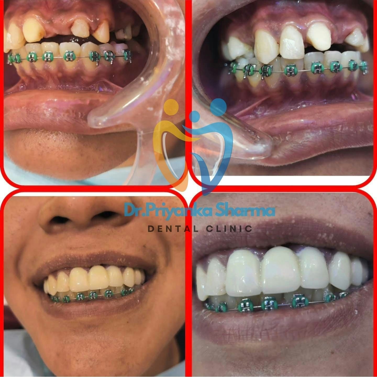 Dr Priyanka Sharma Dental Clinic gallery image