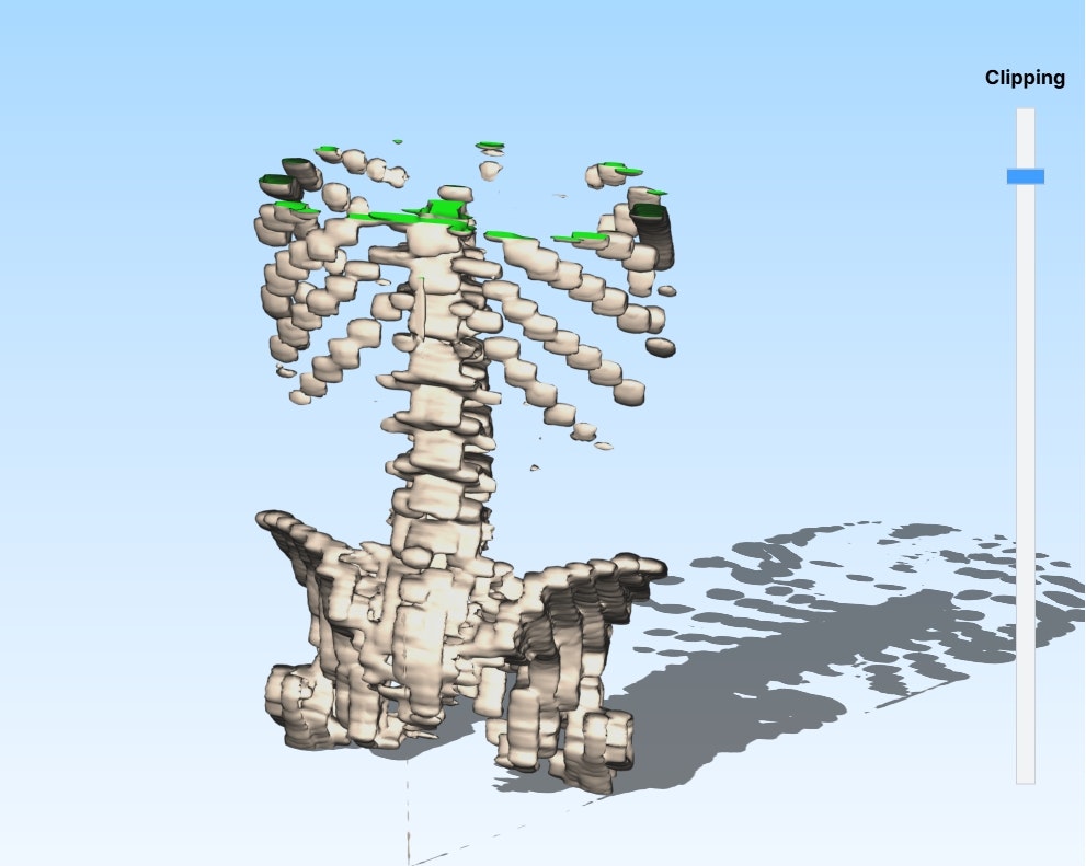 dicomtostl - DICOM2STL, 의료 3D 모델 생성기, DICOMTOSTL 변환기 미디어 2