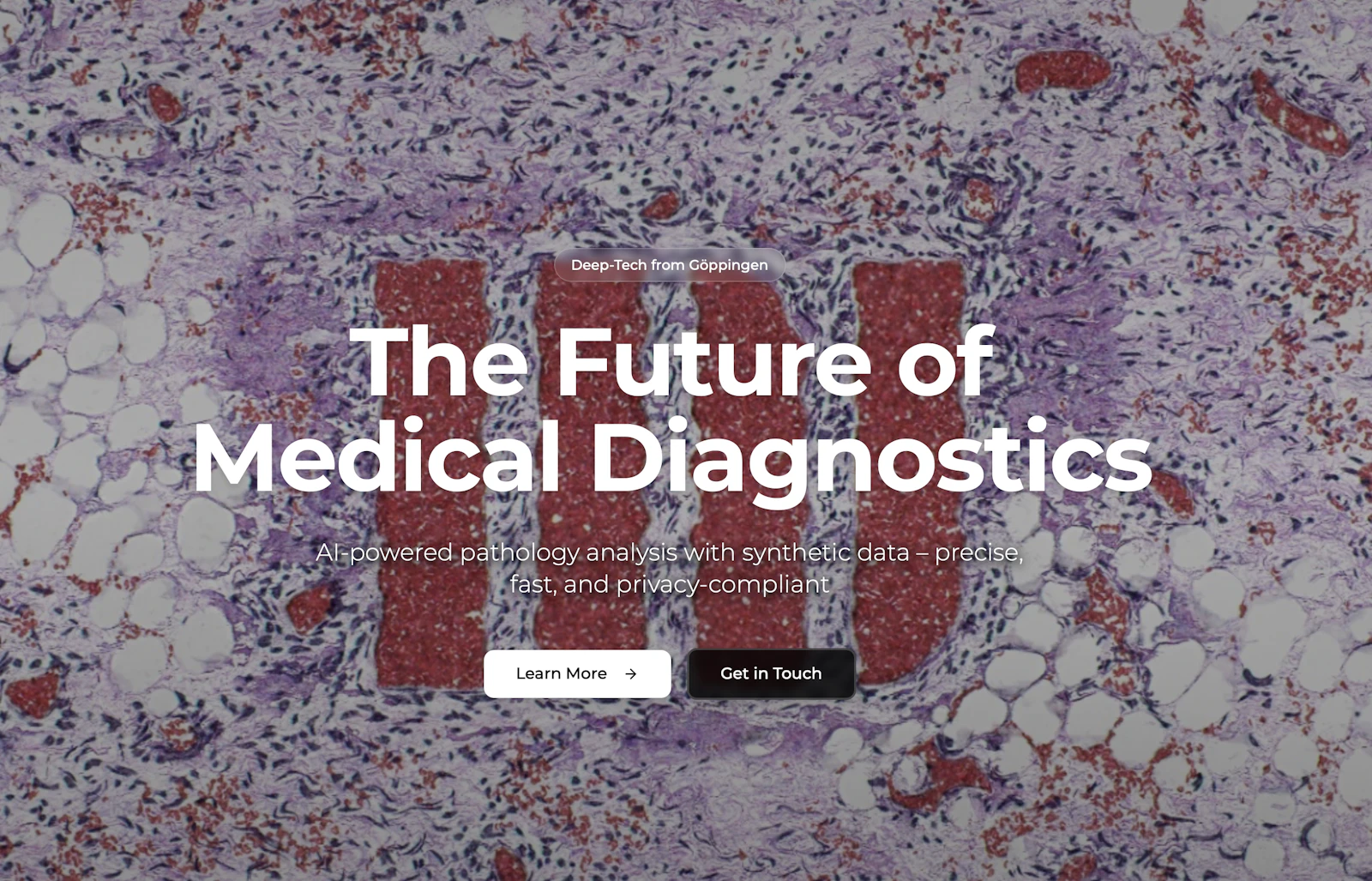 MIRA vision screenshot 1