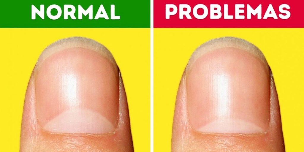 CNN - Serious Health Problem the Moons on Your Nail Warn You About | Product Hunt