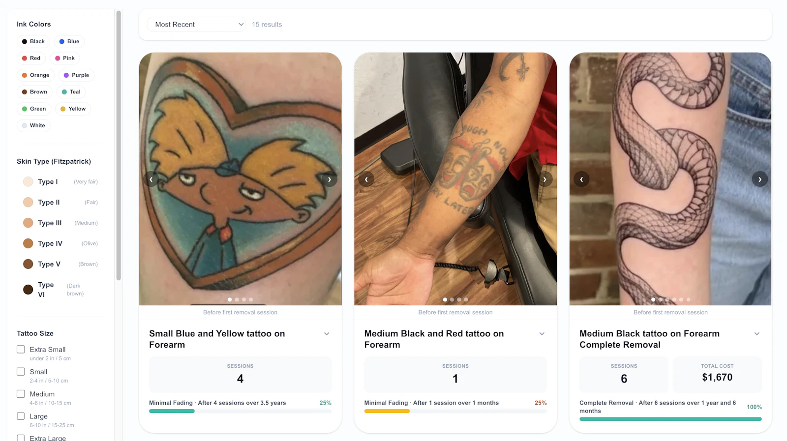 Search Tattoo Removal screenshot 1