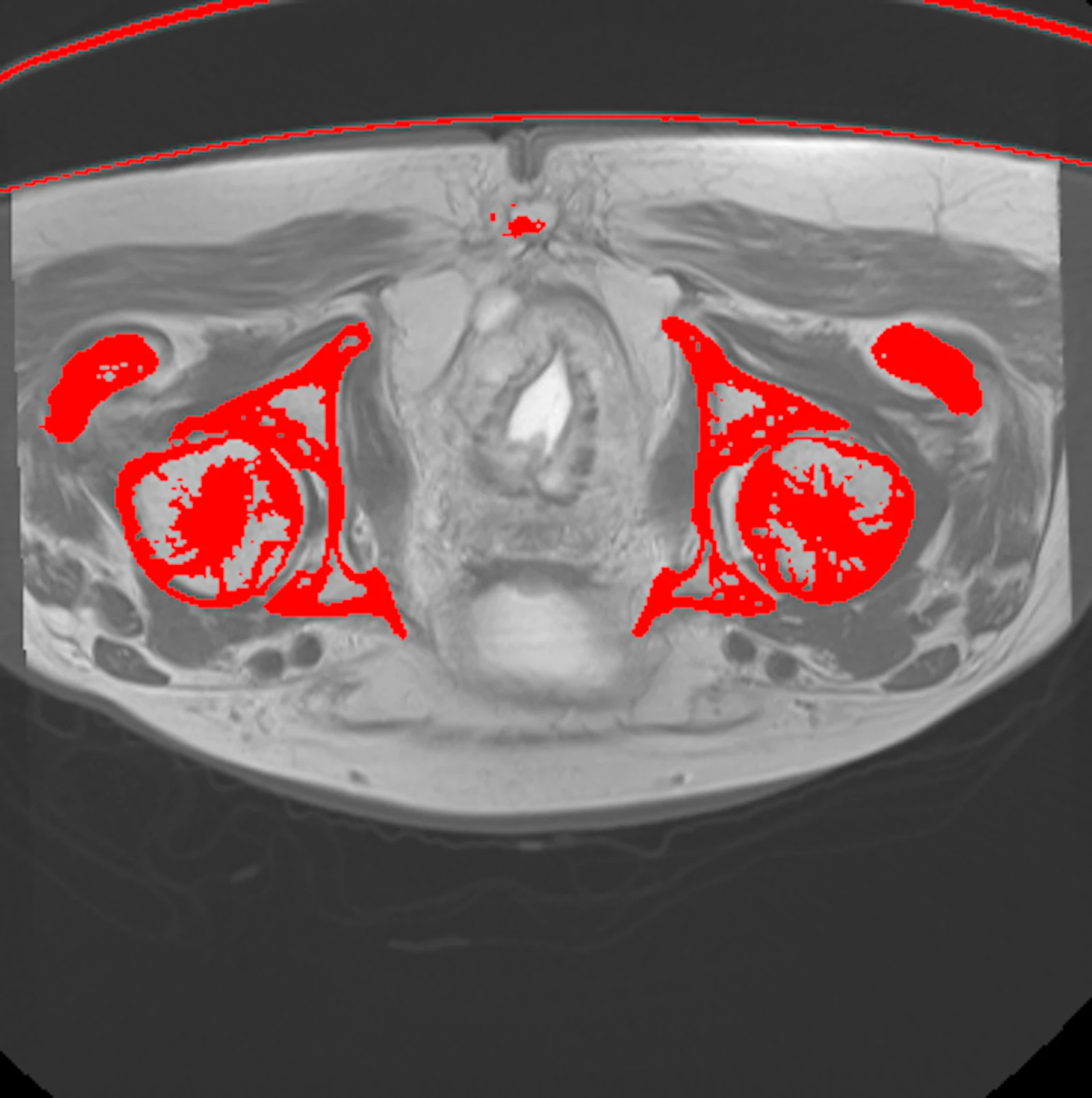 Multimodal image registration screenshot 2