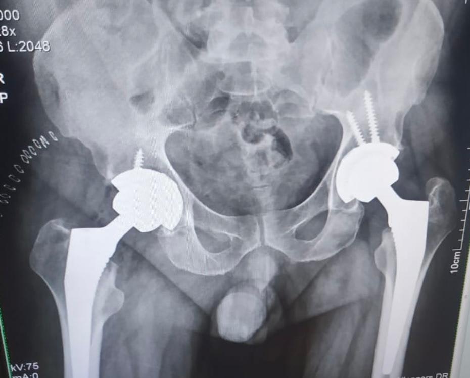 Dr. Vikramjit Singh Baath | ORTHOPRO gallery image