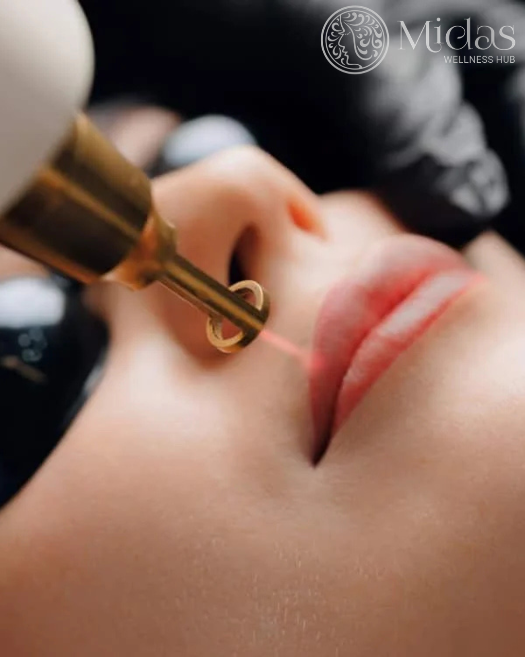 Skin Lightening Treatment gallery image