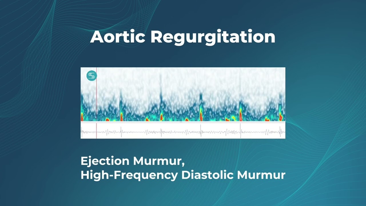 Stethophone Pro gallery image