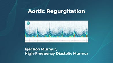 Stethophone Pro gallery image