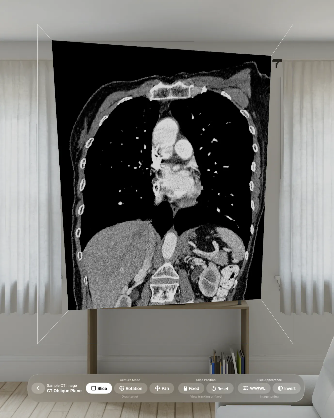 VoxelVision - DICOM Viewer gallery image