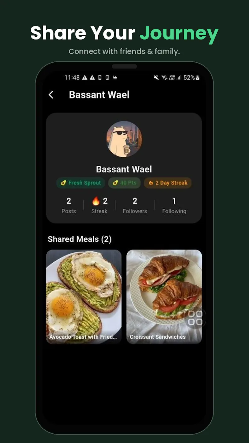Avora: AI Calorie Tracker screenshot 6