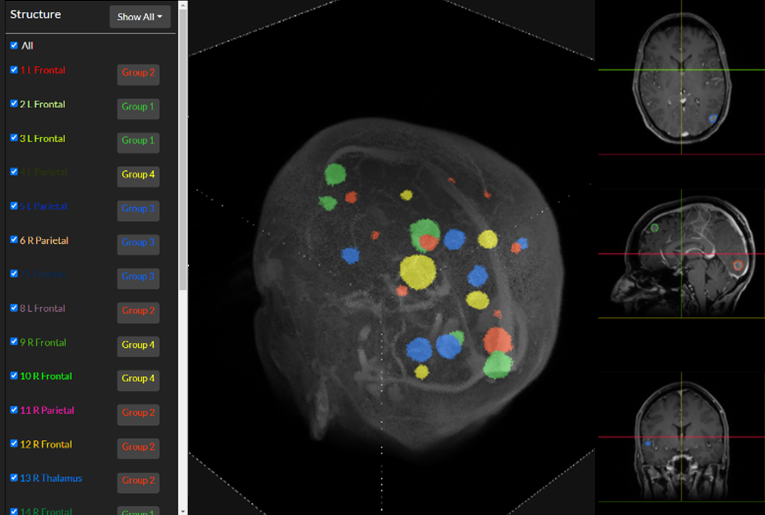 NeuralRad Brain
