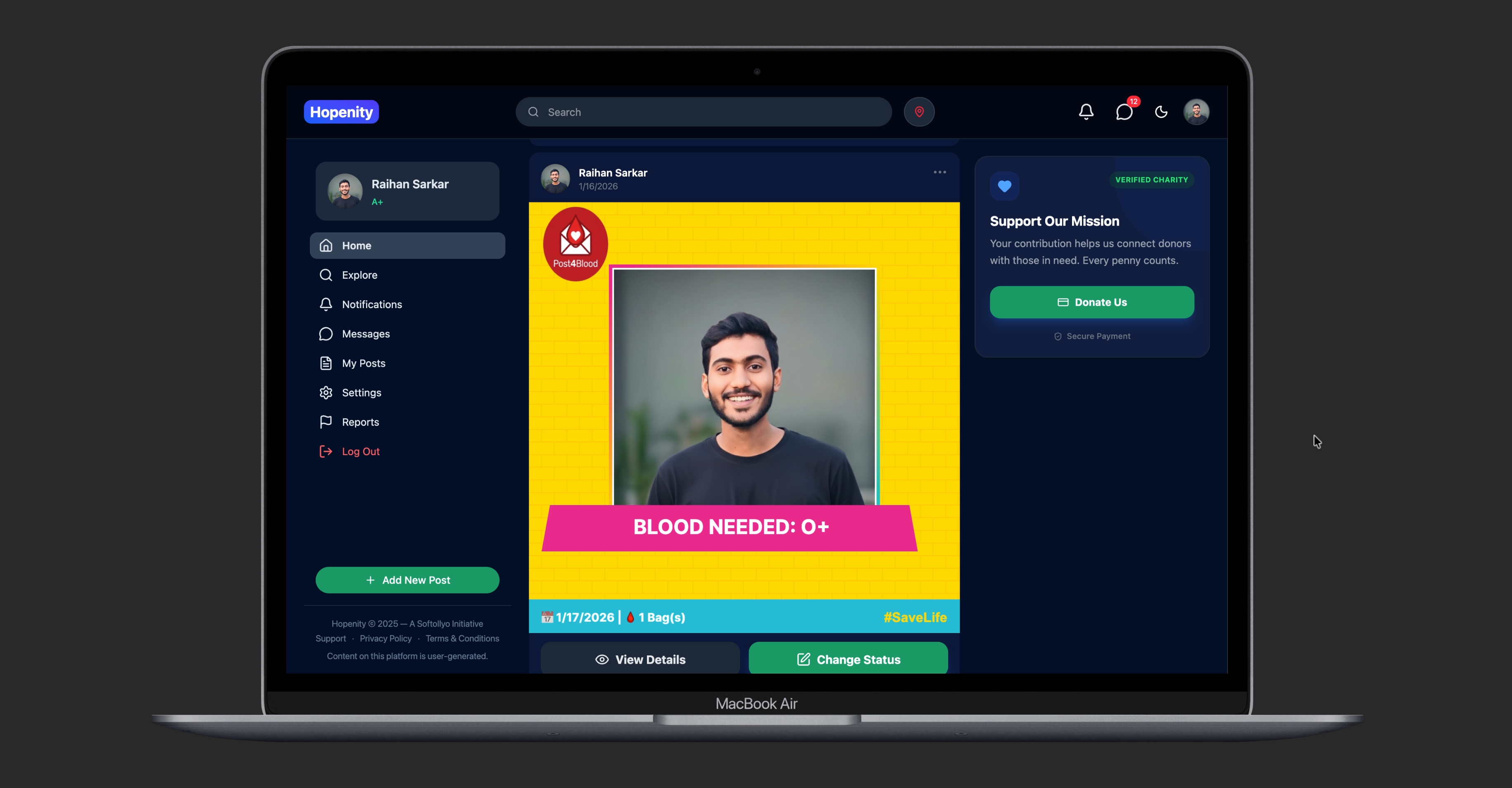 Hopenity - Screenshot 2 showing product features and functionality