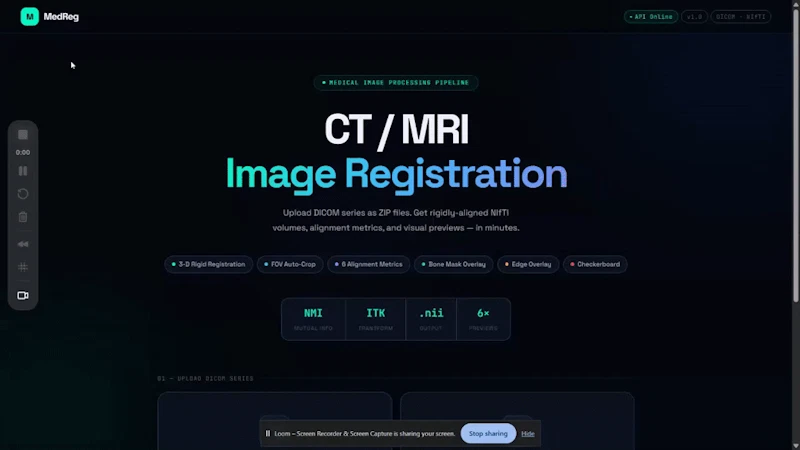 Multimodal image registration screenshot 1 (video preview)