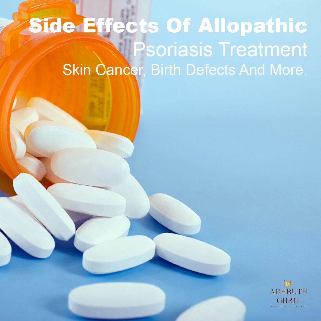 PSORIASIS gallery image