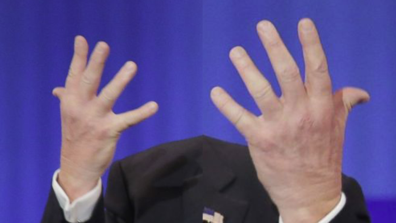 Botald Drumpf gallery image